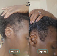 Avant après cure pousse cheveux In Haircare
